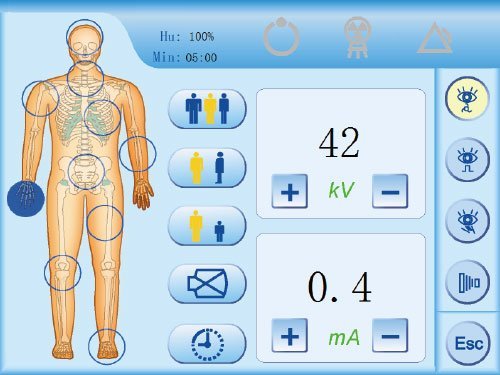 painel-do-arco-cirurgico-plx118f-opusmedical