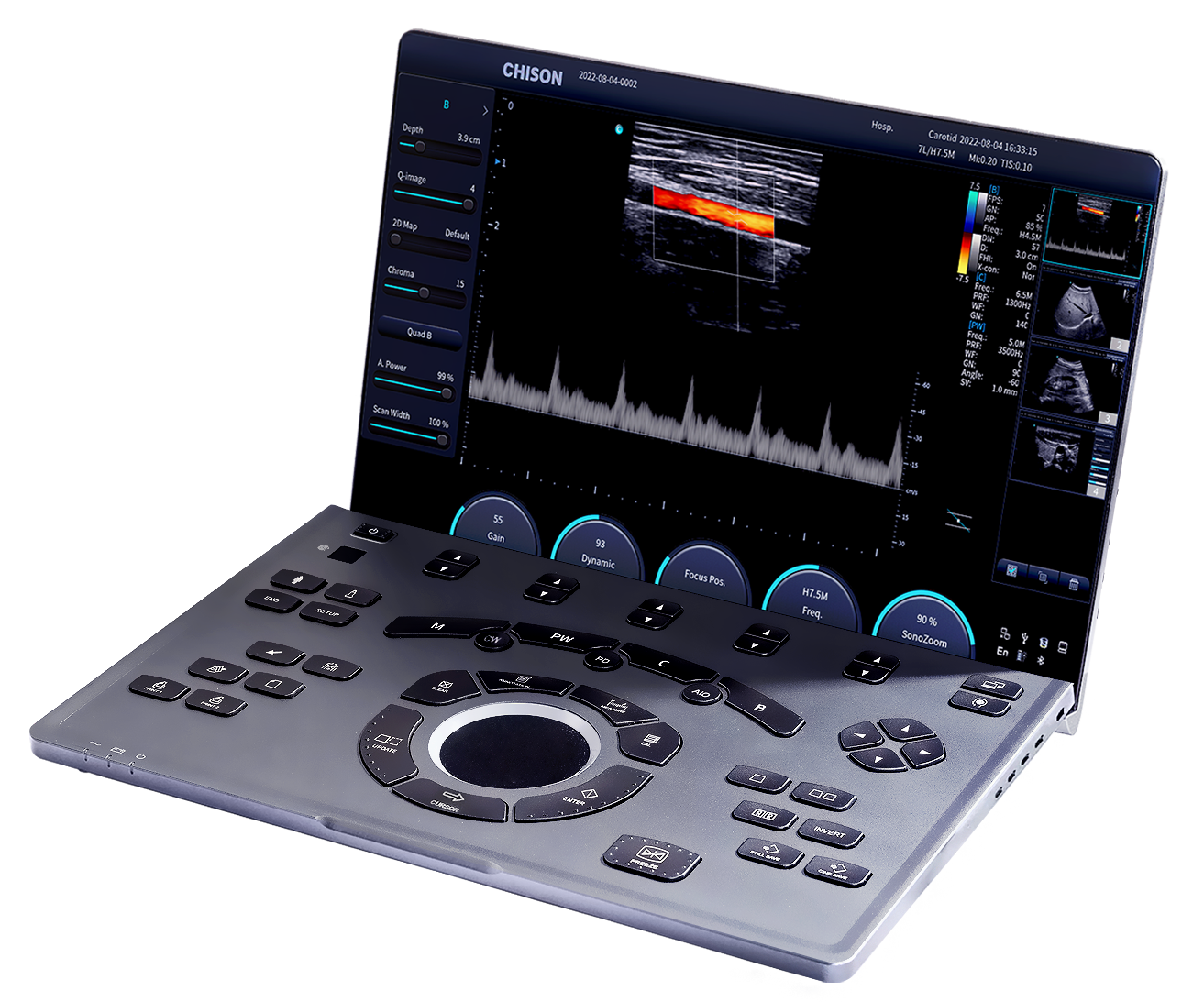 Para qualquer lugar com o SonoAir 70 