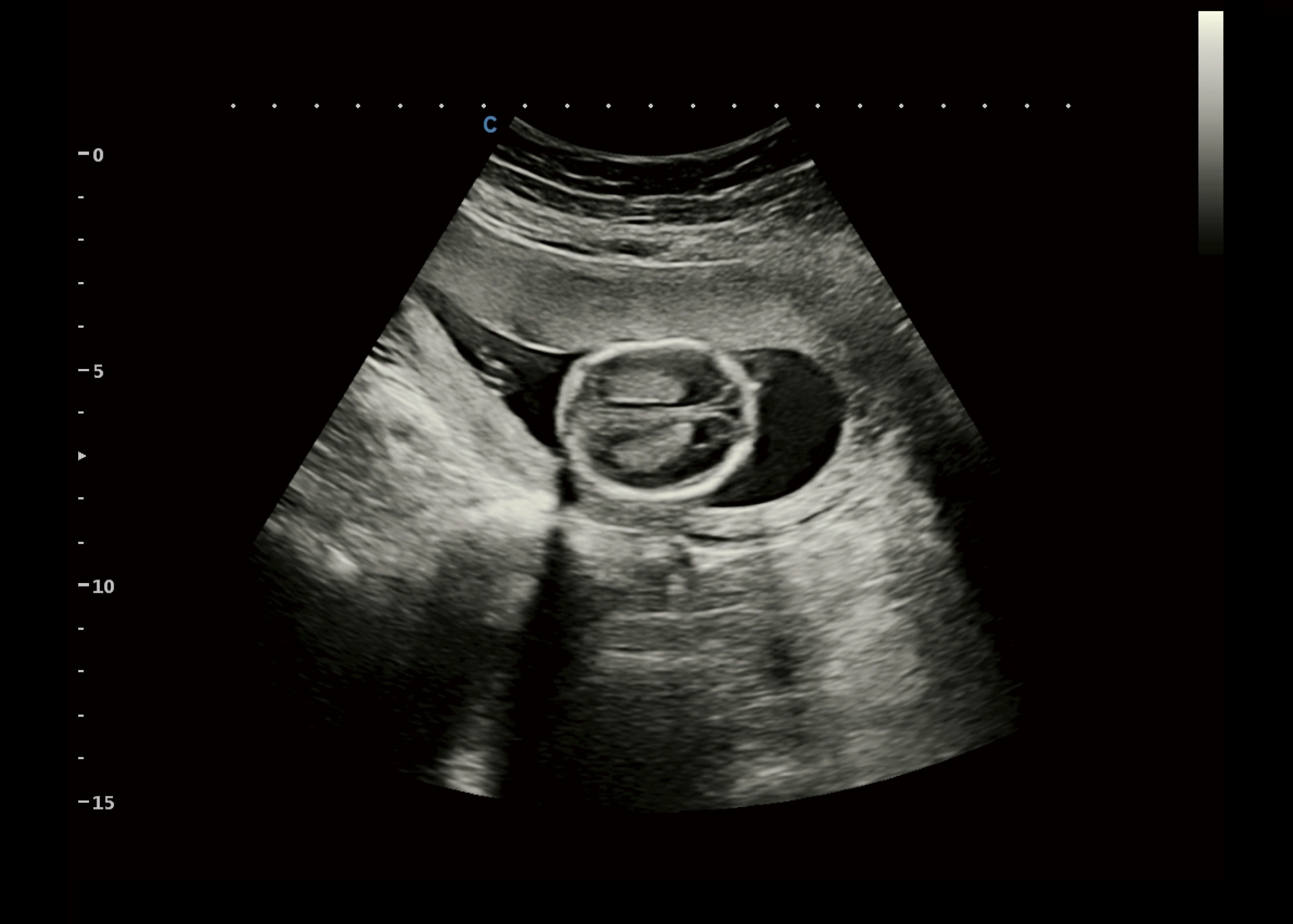 Cbit10 imagens clinicas-5