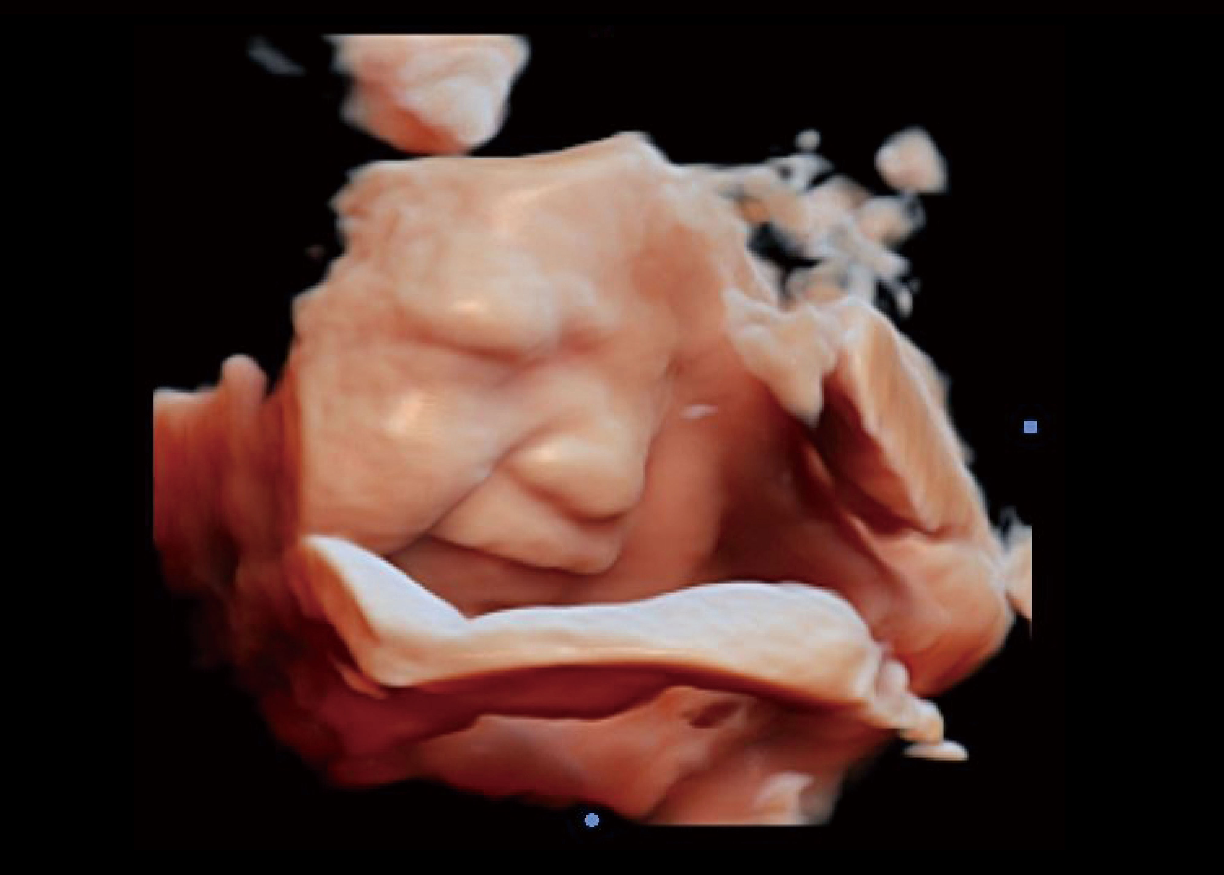 Cbit10 imagens clinicas-6