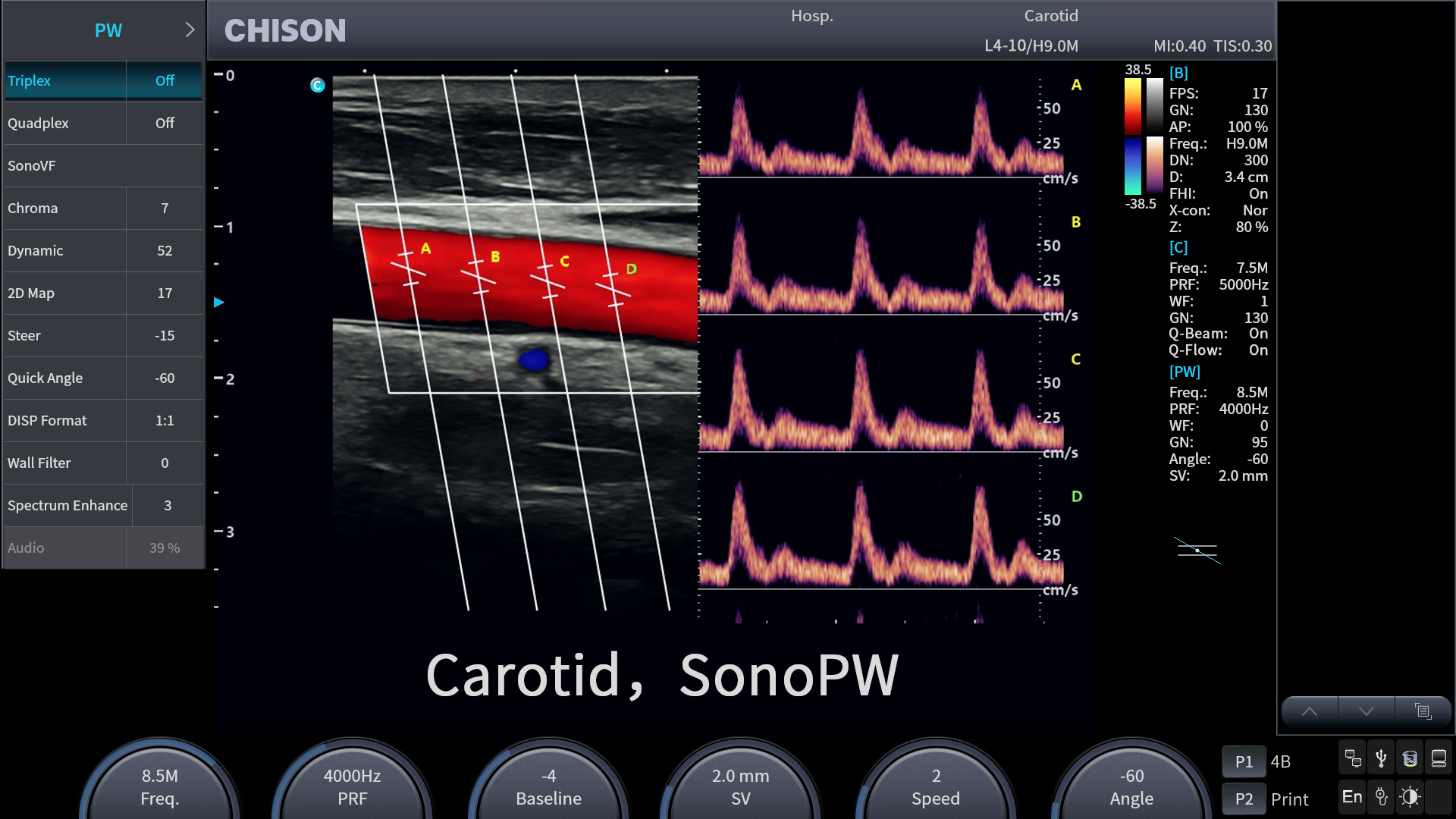 sonogo 4