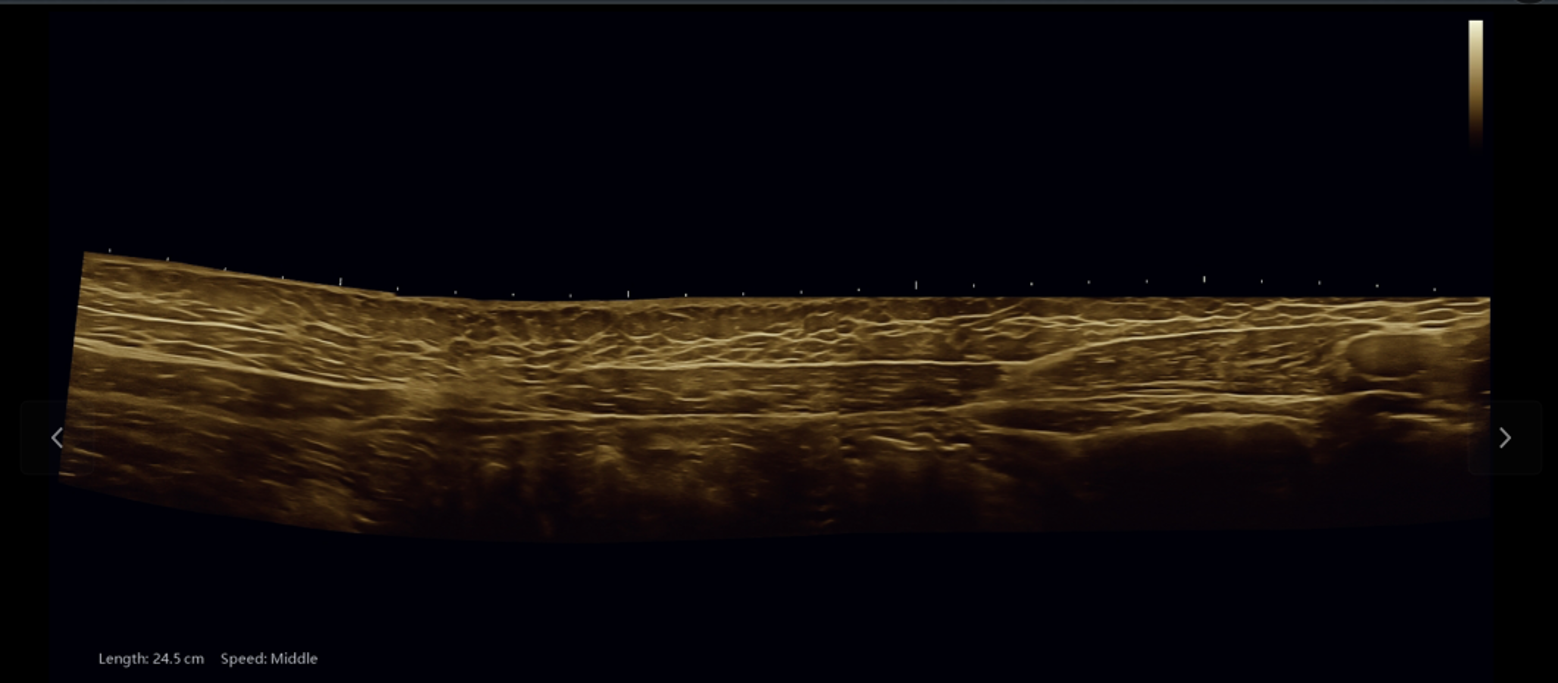 sonogo 5