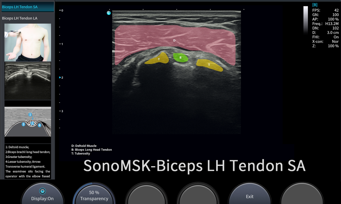 sonogo 6
