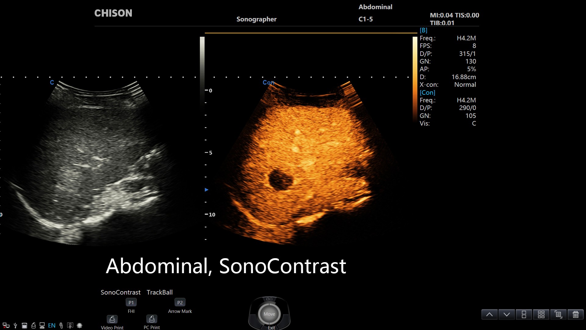 sonoport 8