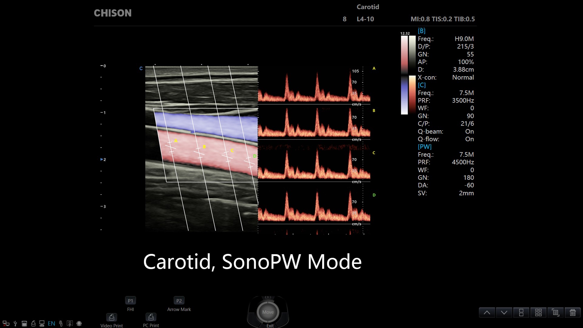 sonoport 9