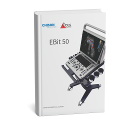 Mokup capa Ebit50