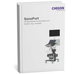 Mokup capa SonoAir (2)