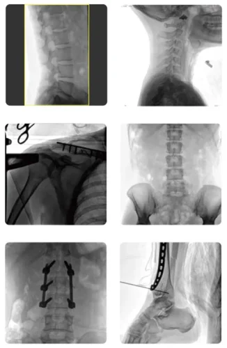 Plx119c imagem clinica02