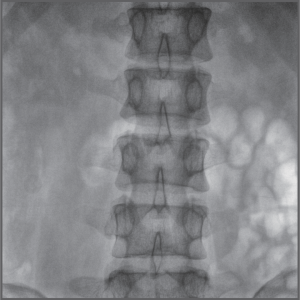 imagem-clinica-arco-cirurgico-plx118f-opusmedical