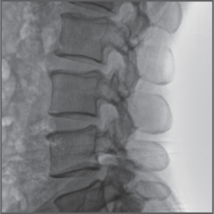 imagem-clinica-arco-cirurgico-plx118f-opusmedical